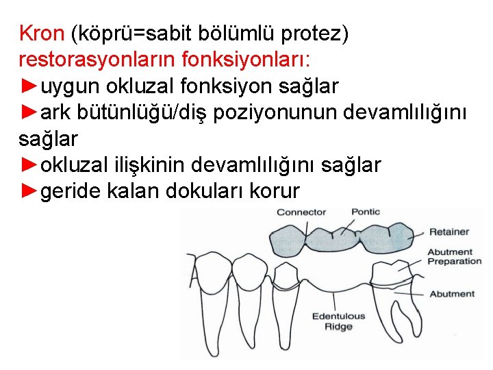 Kron (köprü=sabit bölümlü protez) restorasyonların fonksiyonları: ►uygun okluzal fonksiyon sağlar ►ark bütünlüğü/diş poziyonunun devamlılığını Kron (köprü=sabit bölümlü protez) restorasyonların fonksiyonları: ►uygun okluzal fonksiyon sağlar ►ark bütünlüğü/diş poziyonunun devamlılığını