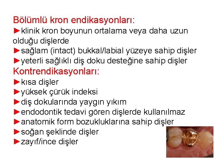 Bölümlü kron endikasyonları: ►klinik kron boyunun ortalama veya daha uzun olduğu dişlerde ►sağlam (intact) Bölümlü kron endikasyonları: ►klinik kron boyunun ortalama veya daha uzun olduğu dişlerde ►sağlam (intact)