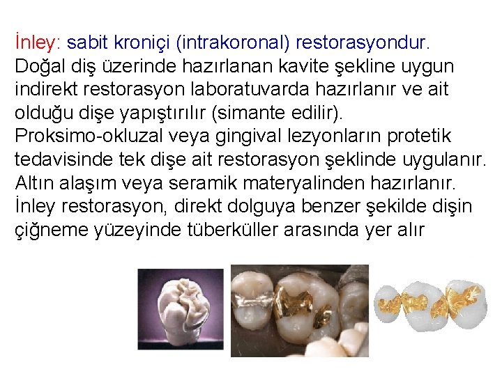 İnley: sabit kroniçi (intrakoronal) restorasyondur. Doğal diş üzerinde hazırlanan kavite şekline uygun indirekt restorasyon İnley: sabit kroniçi (intrakoronal) restorasyondur. Doğal diş üzerinde hazırlanan kavite şekline uygun indirekt restorasyon