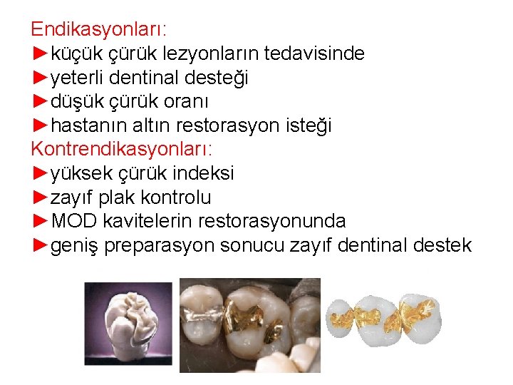 Endikasyonları: ►küçük çürük lezyonların tedavisinde ►yeterli dentinal desteği ►düşük çürük oranı ►hastanın altın restorasyon Endikasyonları: ►küçük çürük lezyonların tedavisinde ►yeterli dentinal desteği ►düşük çürük oranı ►hastanın altın restorasyon