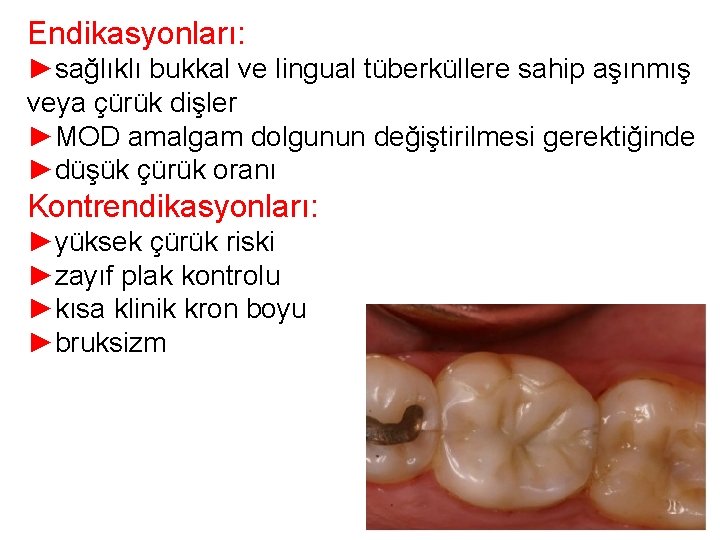 Endikasyonları: ►sağlıklı bukkal ve lingual tüberküllere sahip aşınmış veya çürük dişler ►MOD amalgam dolgunun Endikasyonları: ►sağlıklı bukkal ve lingual tüberküllere sahip aşınmış veya çürük dişler ►MOD amalgam dolgunun