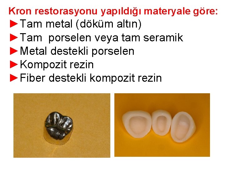 Kron restorasyonu yapıldığı materyale göre: ►Tam metal (döküm altın) ►Tam porselen veya tam seramik Kron restorasyonu yapıldığı materyale göre: ►Tam metal (döküm altın) ►Tam porselen veya tam seramik