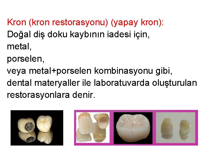 Kron (kron restorasyonu) (yapay kron): Doğal diş doku kaybının iadesi için, metal, porselen, veya Kron (kron restorasyonu) (yapay kron): Doğal diş doku kaybının iadesi için, metal, porselen, veya