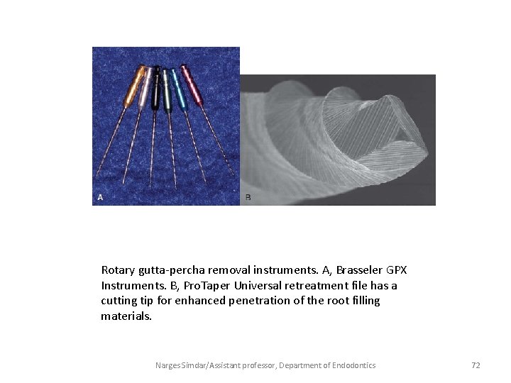 Rotary gutta-percha removal instruments. A, Brasseler GPX Instruments. B, Pro. Taper Universal retreatment file