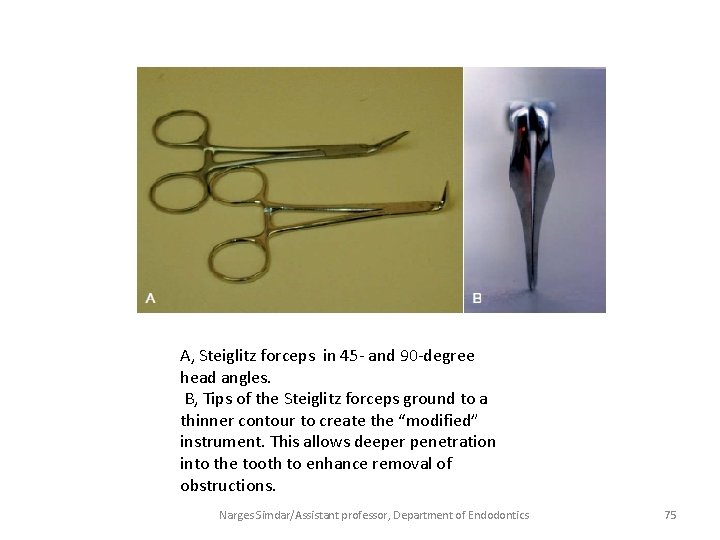 A, Steiglitz forceps in 45 - and 90 -degree head angles. B, Tips of