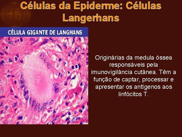 Células da Epiderme: Células Langerhans Originárias da medula óssea responsáveis pela imunovigilância cutânea. Têm