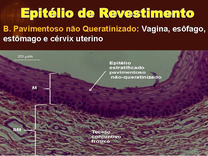 B. Pavimentoso não Queratinizado: Vagina, esôfago, estômago e cérvix uterino 