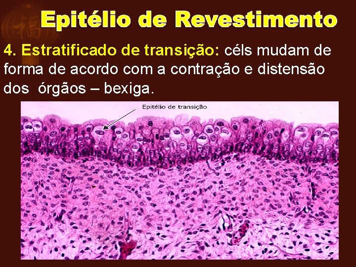 4. Estratificado de transição: céls mudam de forma de acordo com a contração e