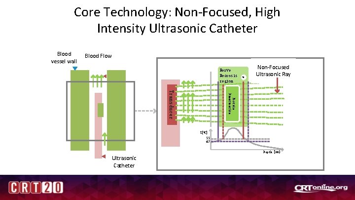 Core Technology: Non-Focused, High Intensity Ultrasonic Catheter Blood vessel wall Blood Flow Nerve Necrosis