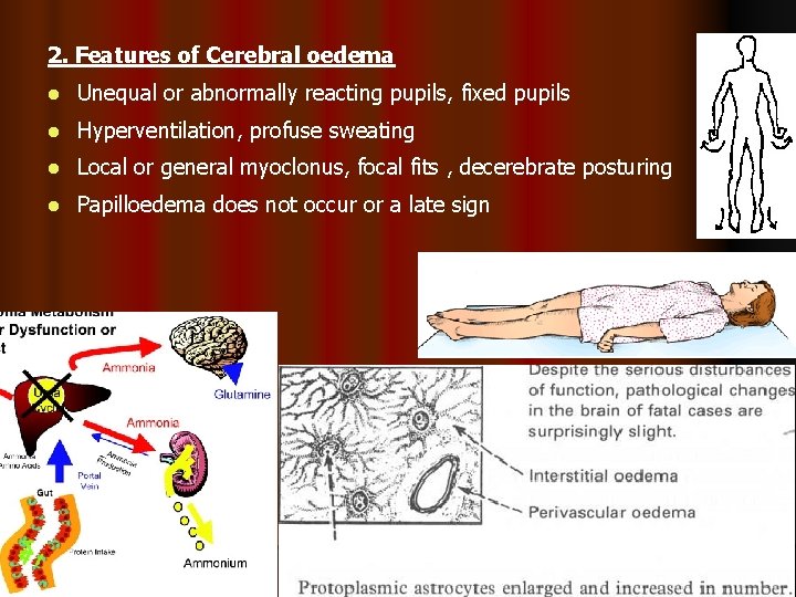 Acute Fulminant Hepatic Failure FHF l Syndrome in