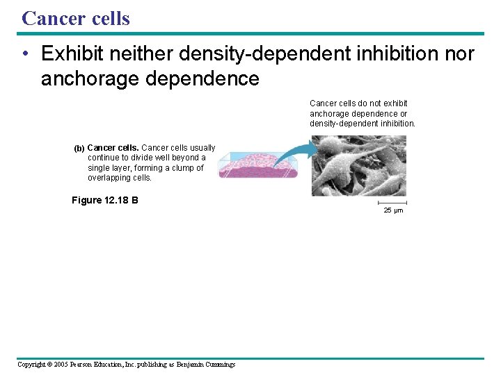 Cancer cells • Exhibit neither density-dependent inhibition nor anchorage dependence Cancer cells do not Cancer cells • Exhibit neither density-dependent inhibition nor anchorage dependence Cancer cells do not