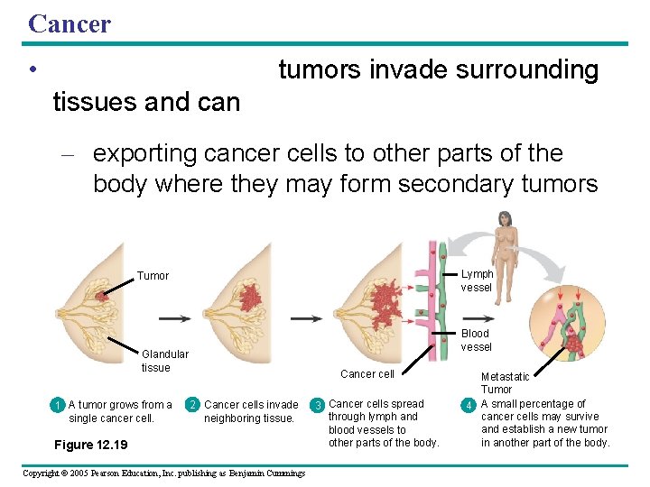 Cancer • tumors invade surrounding tissues and can – exporting cancer cells to other Cancer • tumors invade surrounding tissues and can – exporting cancer cells to other
