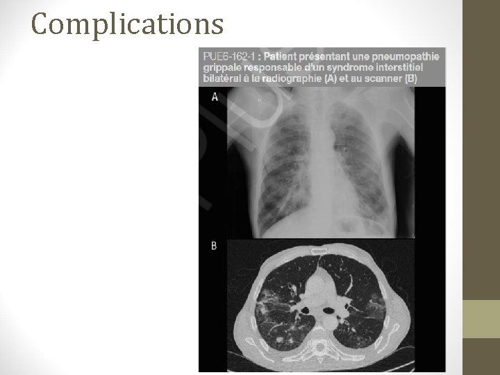 Complications 