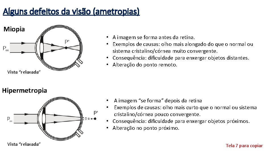 Alguns defeitos da visão (ametropias) Miopia • A imagem se forma antes da retina.