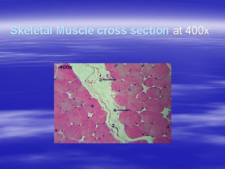 Skeletal Muscle cross section at 400 x 