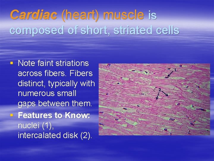 Cardiac (heart) muscle is composed of short, striated cells § Note faint striations across