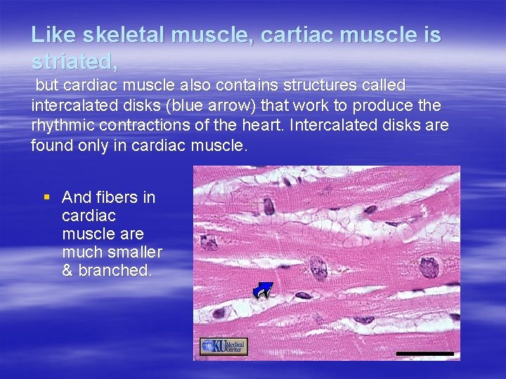 Like skeletal muscle, cartiac muscle is striated, but cardiac muscle also contains structures called