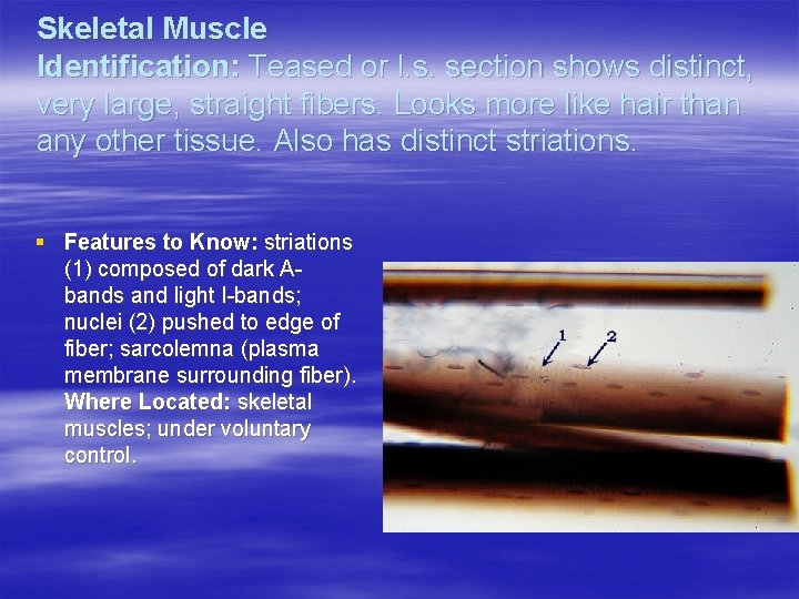 Skeletal Muscle Identification: Teased or l. s. section shows distinct, very large, straight fibers.