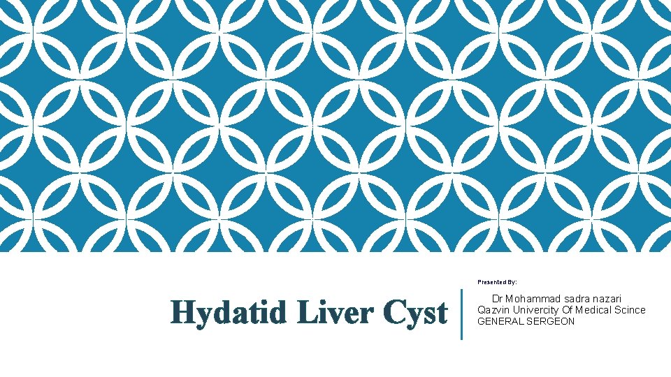 Presented By: Hydatid Liver Cyst Dr Mohammad sadra nazari Qazvin Univercity Of Medical Scince