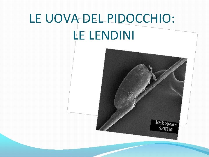 LE UOVA DEL PIDOCCHIO: LE LENDINI 