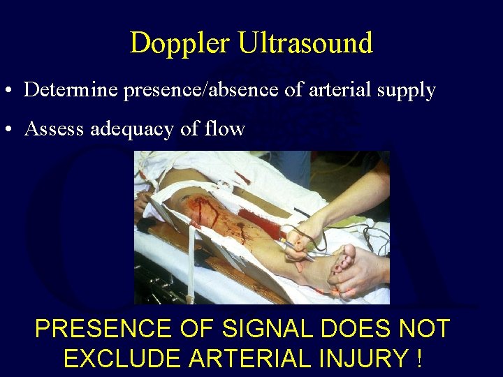 Doppler Ultrasound • Determine presence/absence of arterial supply • Assess adequacy of flow PRESENCE