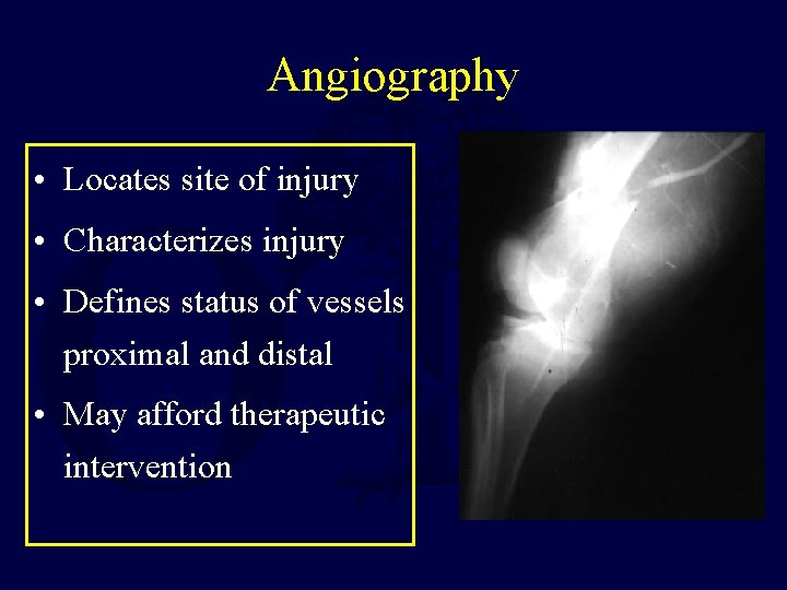 Angiography • Locates site of injury • Characterizes injury • Defines status of vessels