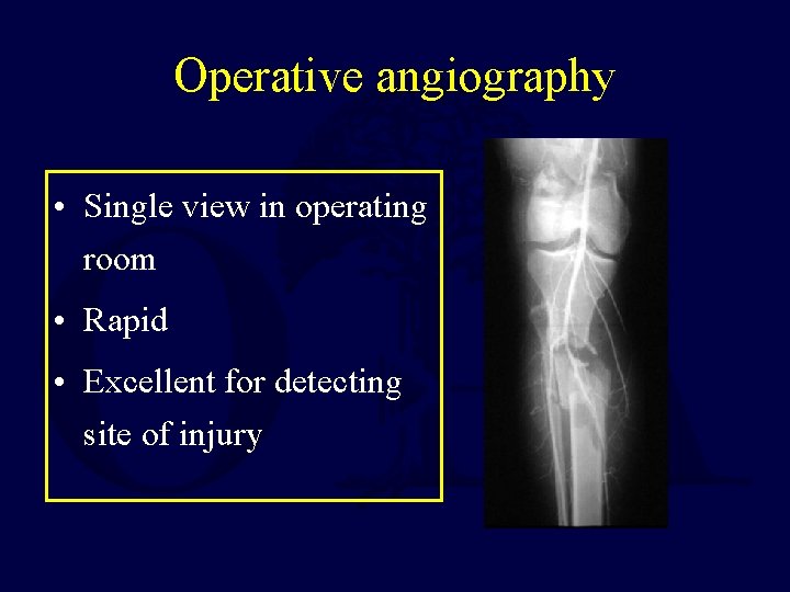 Operative angiography • Single view in operating room • Rapid • Excellent for detecting