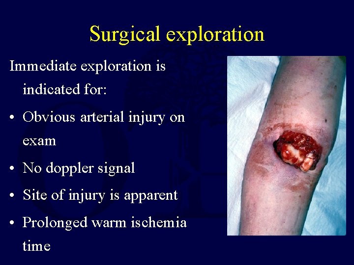 Surgical exploration Immediate exploration is indicated for: • Obvious arterial injury on exam •