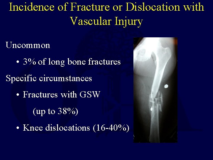 Incidence of Fracture or Dislocation with Vascular Injury Uncommon • 3% of long bone