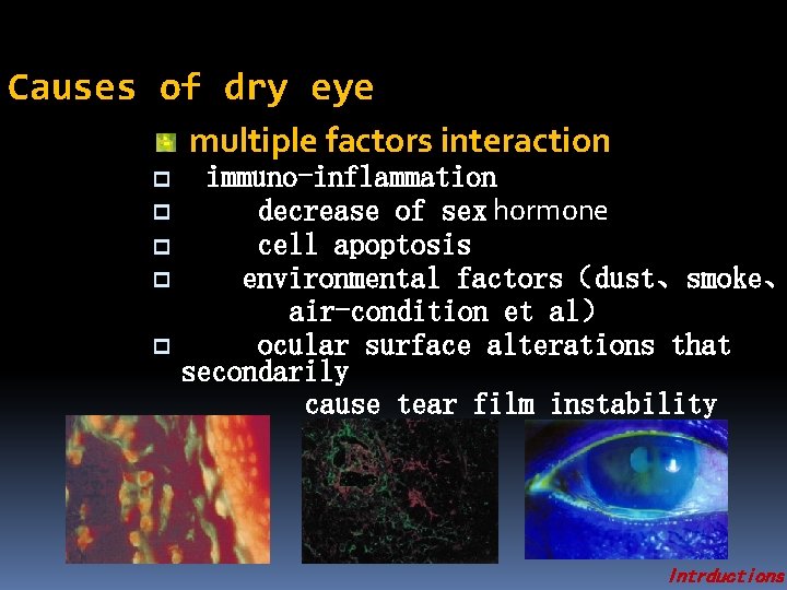 Causes of dry eye multiple factors interaction p p p immuno-inflammation decrease of sex