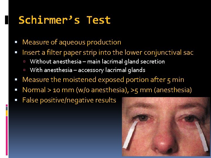 Schirmer’s Test Measure of aqueous production Insert a filter paper strip into the lower