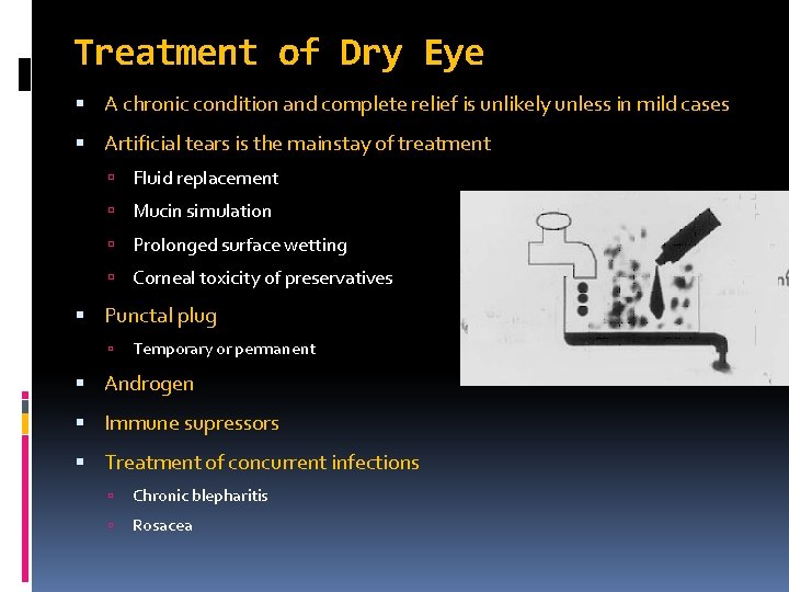 Treatment of Dry Eye A chronic condition and complete relief is unlikely unless in
