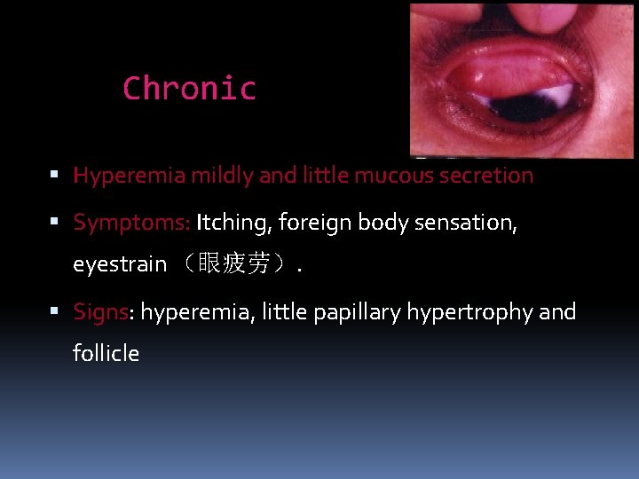 Chronic Hyperemia mildly and little mucous secretion Symptoms: Itching, foreign body sensation, eyestrain （眼疲劳）.