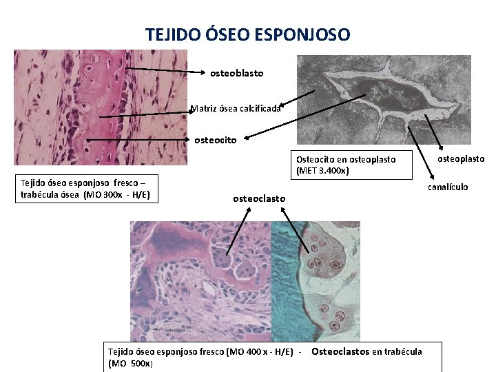 TEJIDO ÓSEO ESPONJOSO osteoblasto Matriz ósea calcificada osteocito Osteocito en osteoplasto (MET 3. 400 TEJIDO ÓSEO ESPONJOSO osteoblasto Matriz ósea calcificada osteocito Osteocito en osteoplasto (MET 3. 400