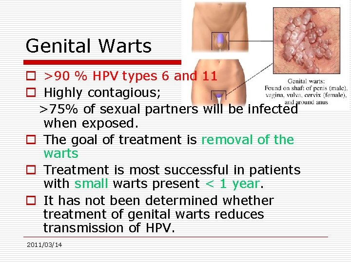Genital Warts o >90 % HPV types 6 and 11 o Highly contagious; >75%