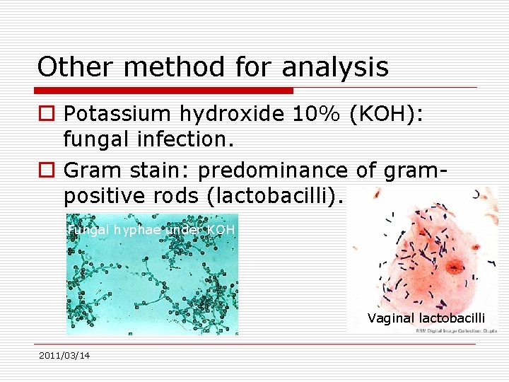 Other method for analysis o Potassium hydroxide 10% (KOH): fungal infection. o Gram stain: