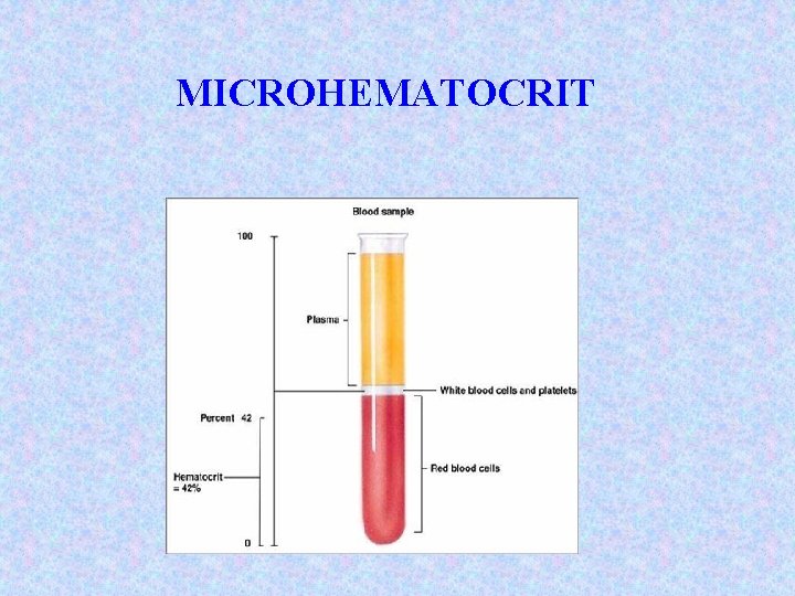 MICROHEMATOCRIT 