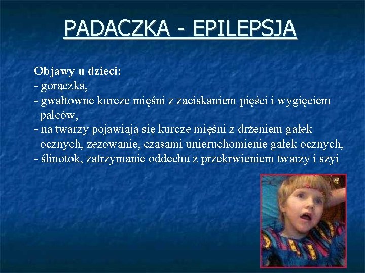 PADACZKA - EPILEPSJA Objawy u dzieci: - gorączka, - gwałtowne kurcze mięśni z zaciskaniem