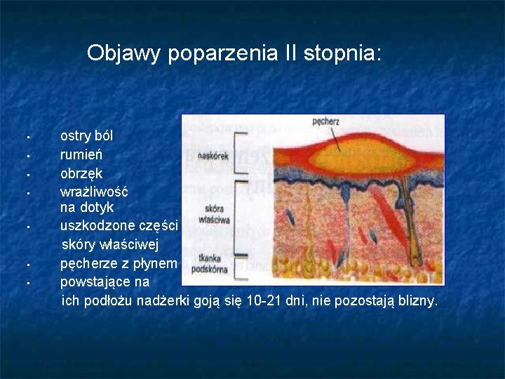 Objawy poparzenia II stopnia: • • ostry ból rumień obrzęk wrażliwość na dotyk uszkodzone