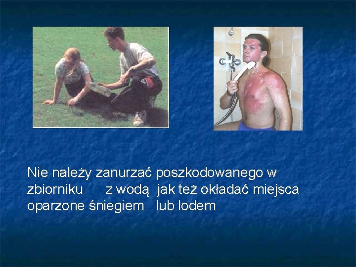 Nie należy zanurzać poszkodowanego w zbiorniku z wodą jak też okładać miejsca oparzone śniegiem