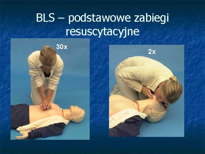 BLS – podstawowe zabiegi resuscytacyjne 30 x 2 x 