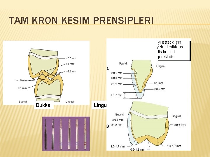 TAM KRON KESIM PRENSIPLERI İyi estetik için yeterli miktarda diş kesimi gereklidir Bukkal Lingual