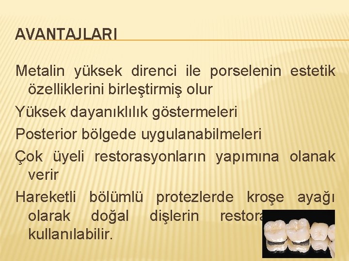 AVANTAJLARI Metalin yüksek direnci ile porselenin estetik özelliklerini birleştirmiş olur Yüksek dayanıklılık göstermeleri Posterior