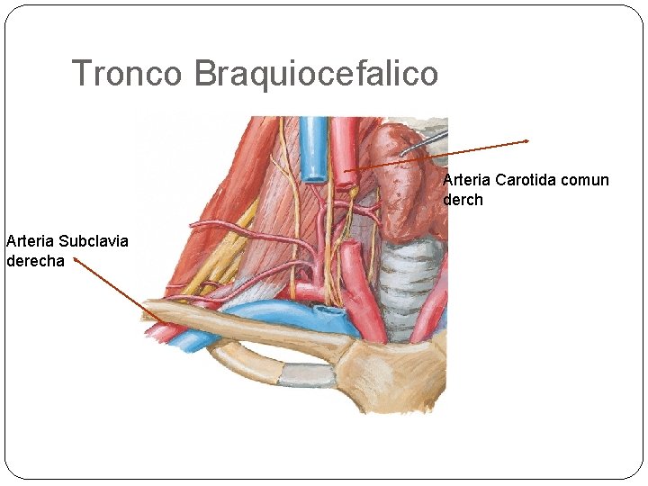 Tronco Braquiocefalico Arteria Carotida comun derch Arteria Subclavia derecha 