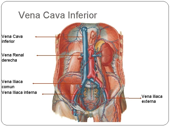 Vena Cava Inferior Vena Cava inferior Vena Renal derecha Vena Iliaca comun Vena Iliaca