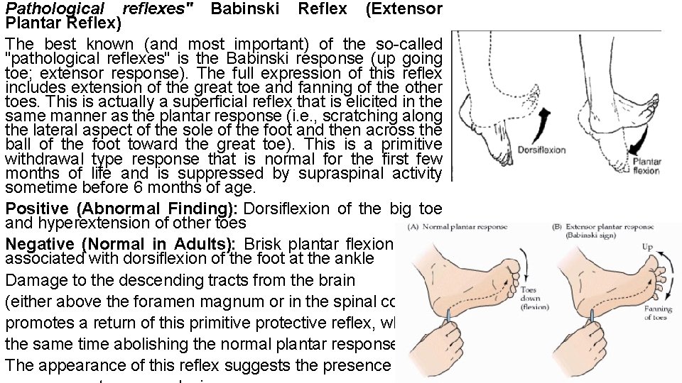 Pathological reflexes" Babinski Reflex (Extensor Plantar Reflex) The best known (and most important) of