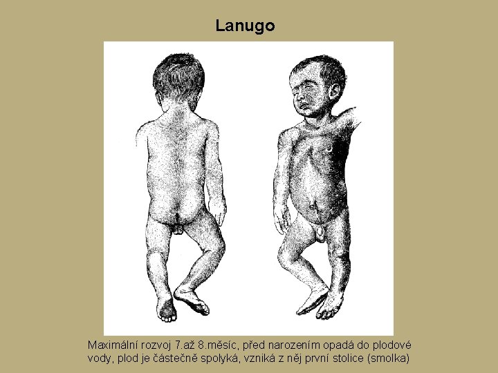 Lanugo Maximální rozvoj 7. až 8. měsíc, před narozením opadá do plodové vody, plod Lanugo Maximální rozvoj 7. až 8. měsíc, před narozením opadá do plodové vody, plod