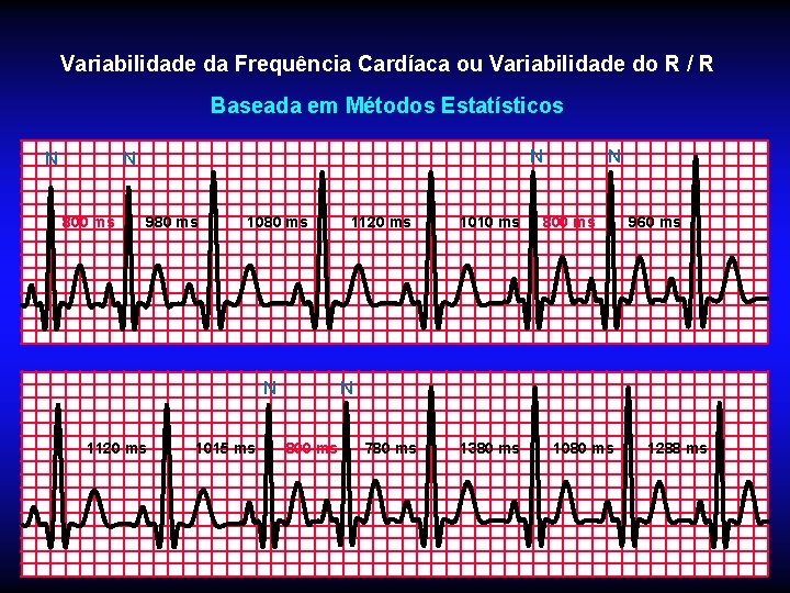 Variabilidade da Frequência Cardíaca ou Variabilidade do R / R Baseada em Métodos Estatísticos