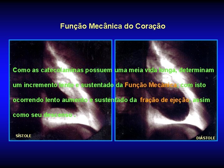 Função Mecânica do Coração Como as catecolaminas possuem uma meia vida longa, determinam um Função Mecânica do Coração Como as catecolaminas possuem uma meia vida longa, determinam um