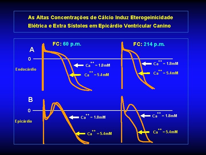 As Altas Concentrações de Cálcio Induz Eterogeinicidade Elétrica e Extra Sístoles em Epicárdio Ventricular